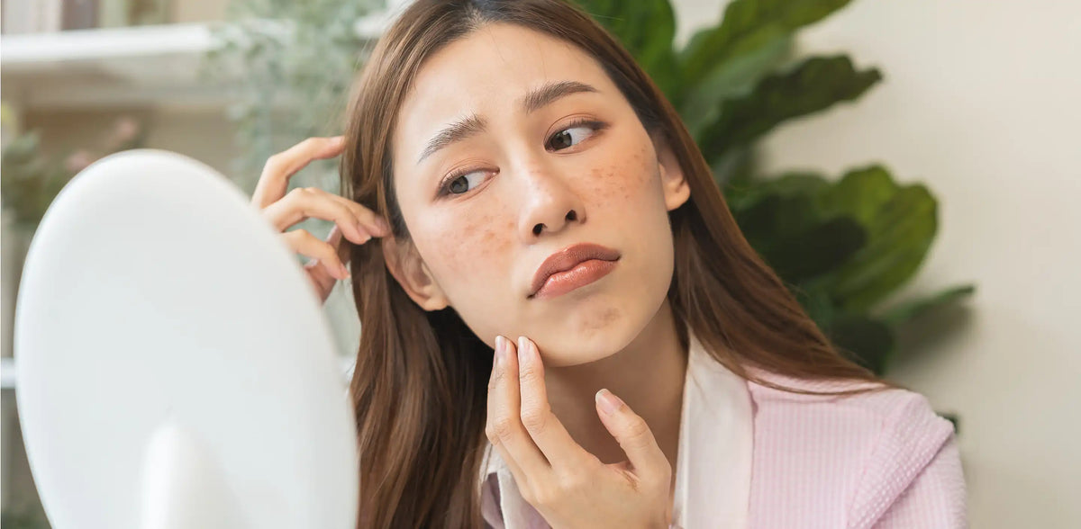 Réduire l'apparence des taches brunes et des imperfections